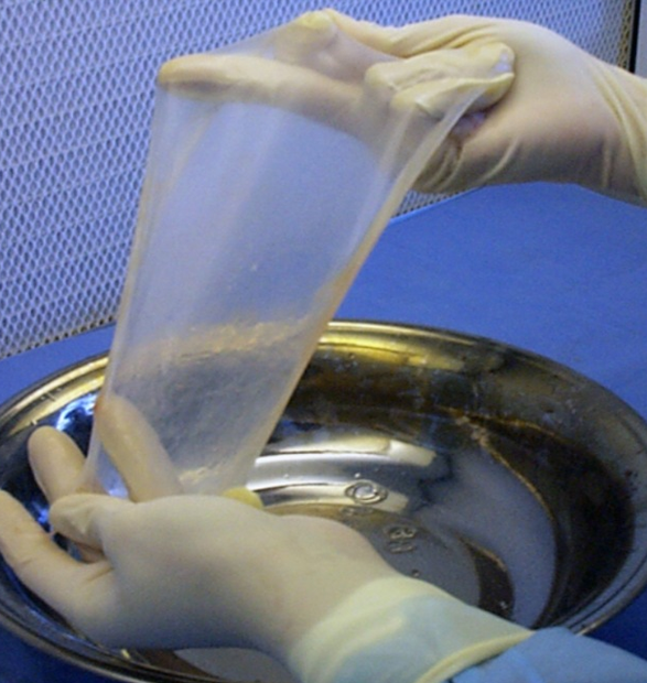 Usos actuales y potencialidades de la membrana amniótica humana en medicina: Estado del arte en Argentina y perspectivas en investigación