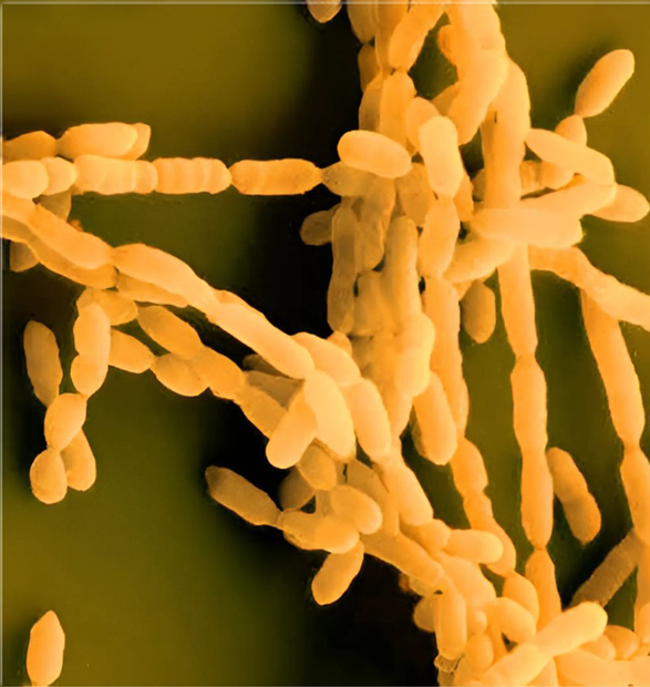 Potencial tecnológico de la cepa autóctona de Oenococcus oeni UNQOe19 para su empleo como iniciador maloláctico